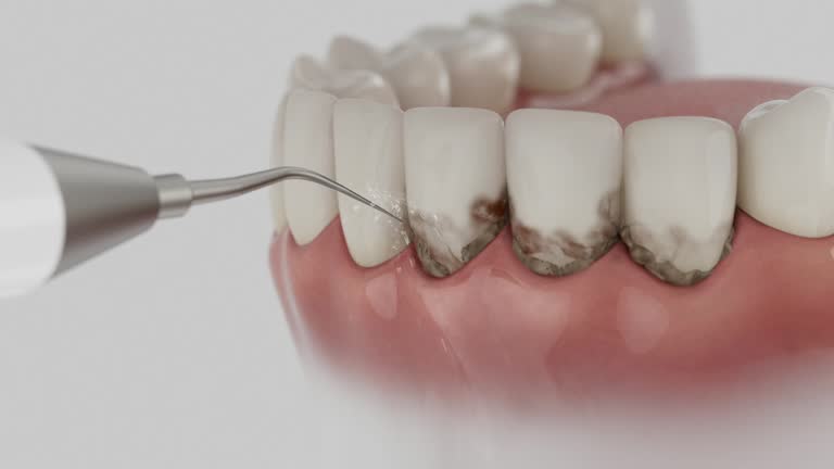 Reliable Tooth Extraction contractor in Winnie, TX by Smile Center Dentistry